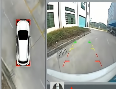 Эффект заднего вида АВМ